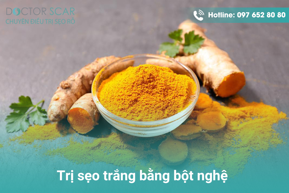 Trị sẹo trắng với bột nghệ