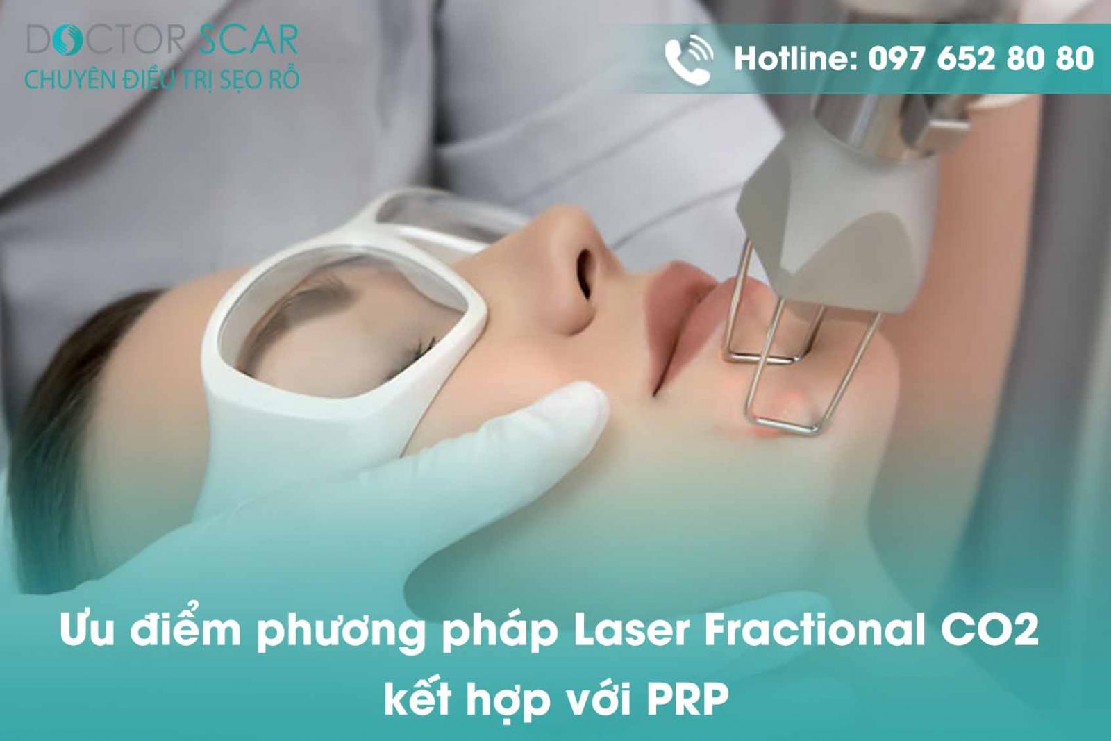 Ưu điểm phương pháp Laser Fractional CO2 kết hợp với PRP