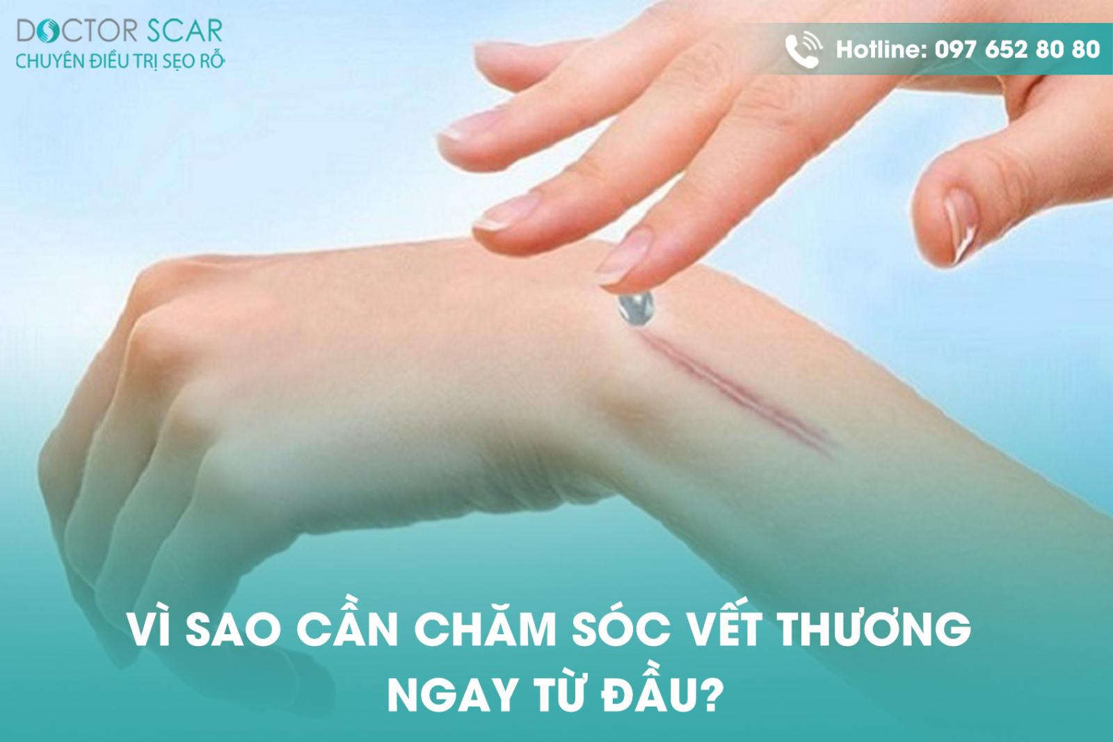 Vì sao cần chăm sóc vết thương ngay từ đầu?