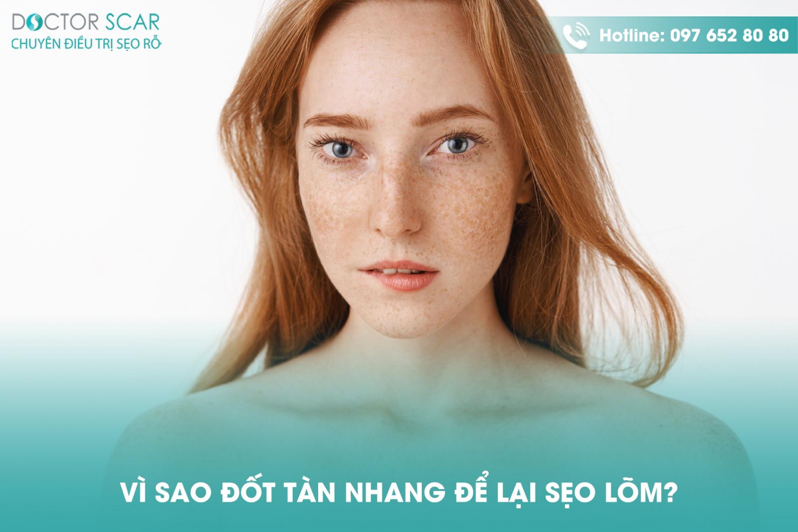 Vì sao đốt tàn nhang để lại sẹo lõm?