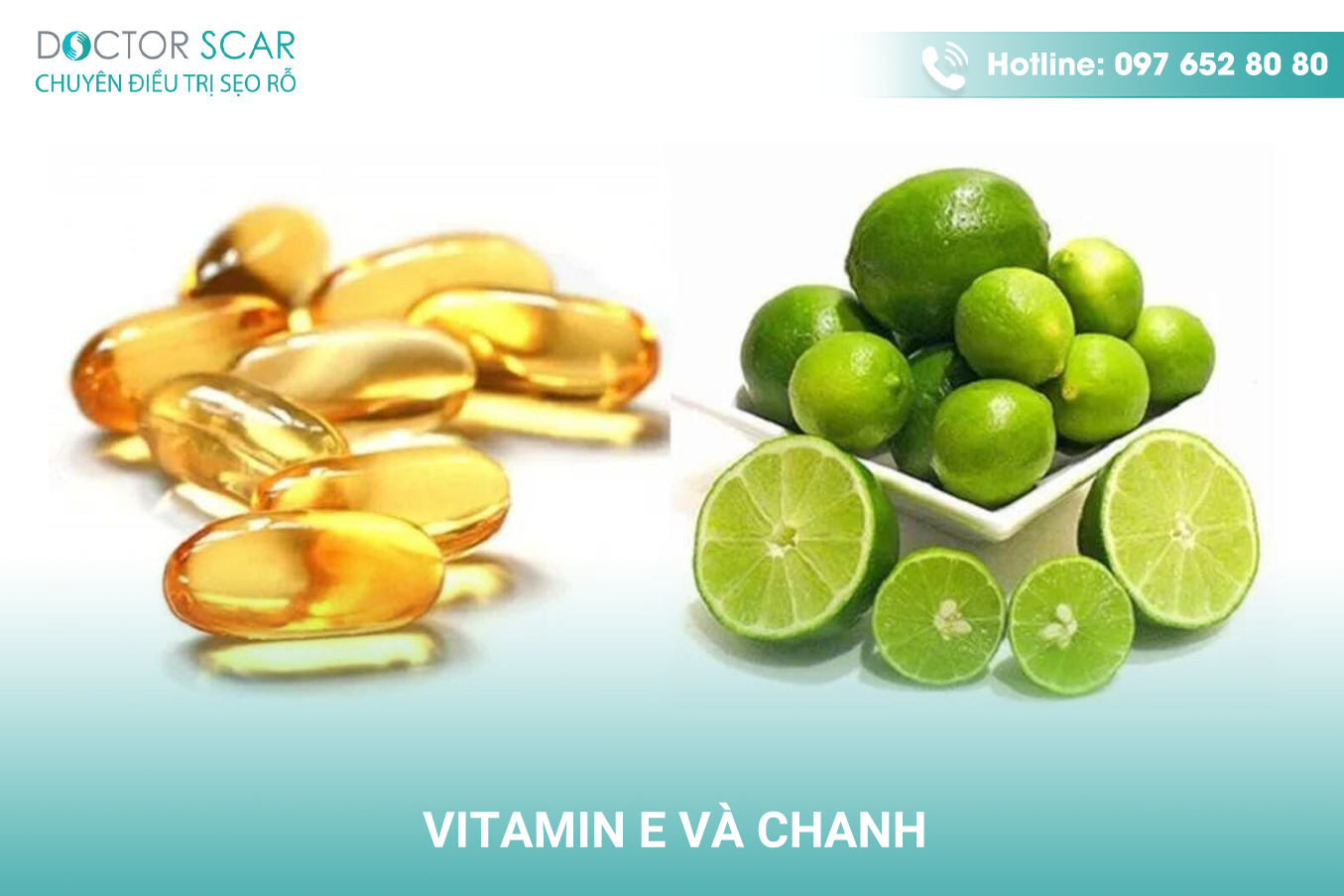 trị sẹo thâm ở chân bằng vitamin E và chanh