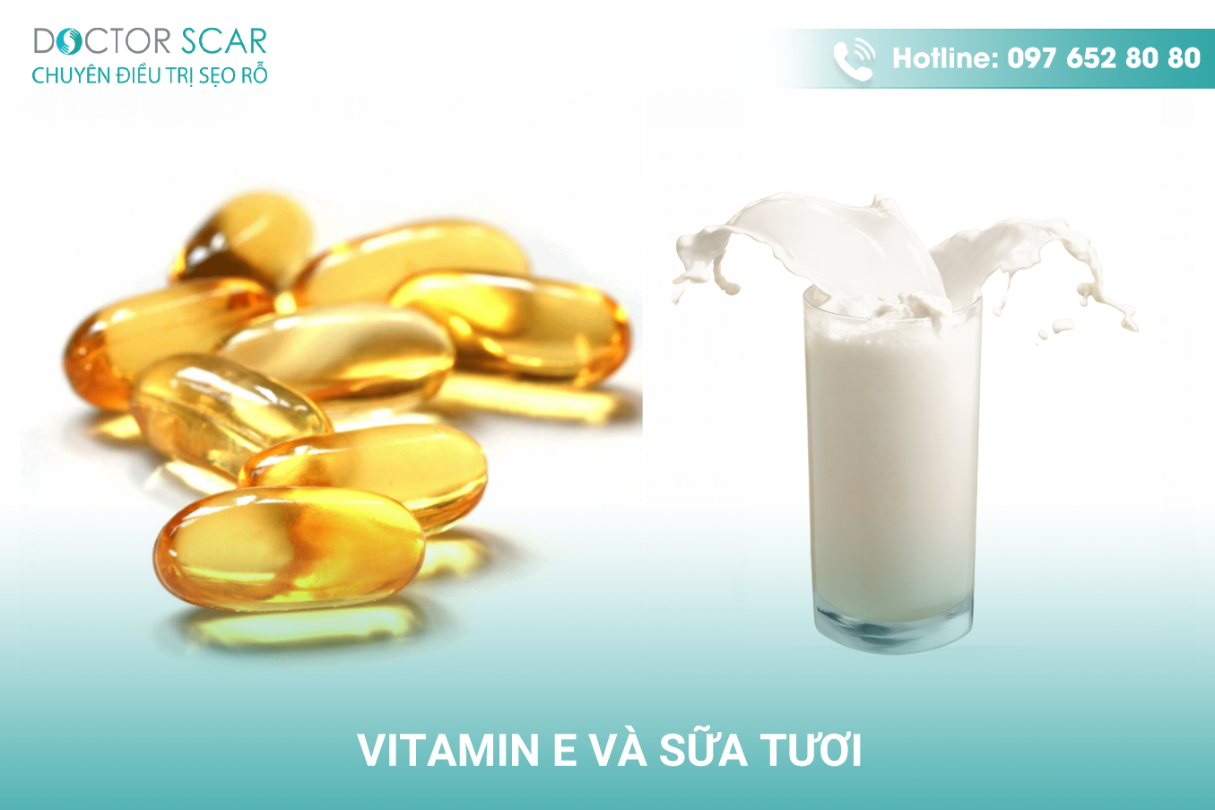 Kết hợp sữa tươi và vitamin e sẽ tăng hiệu quả trong điều trị sẹo thâm ở chân