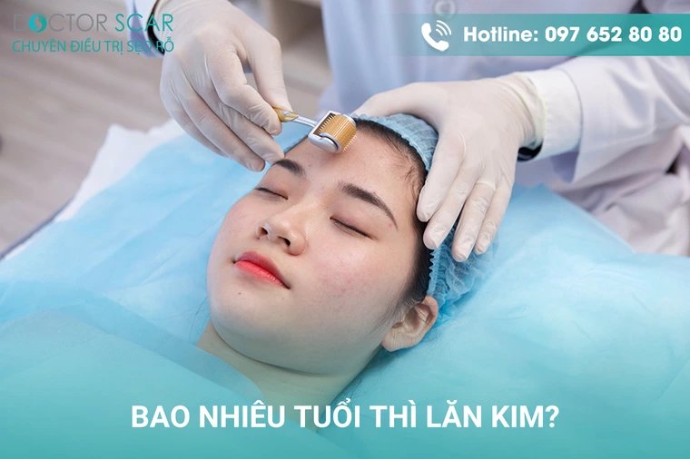 Bao nhiêu tuổi thì lăn kim được