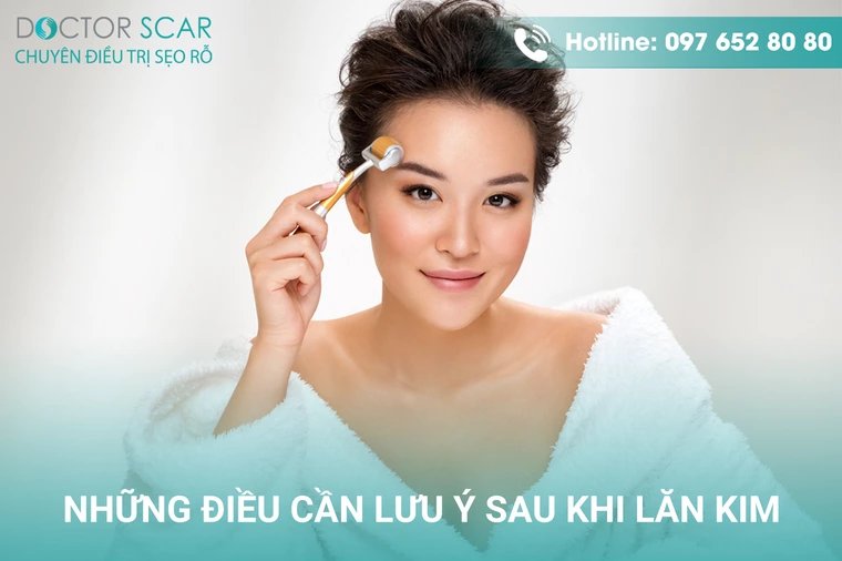 Những điều cần lưu ý sau khi lăn kim.