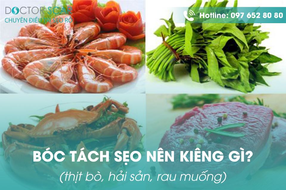 bóc tách sẹo nên kiêng gì