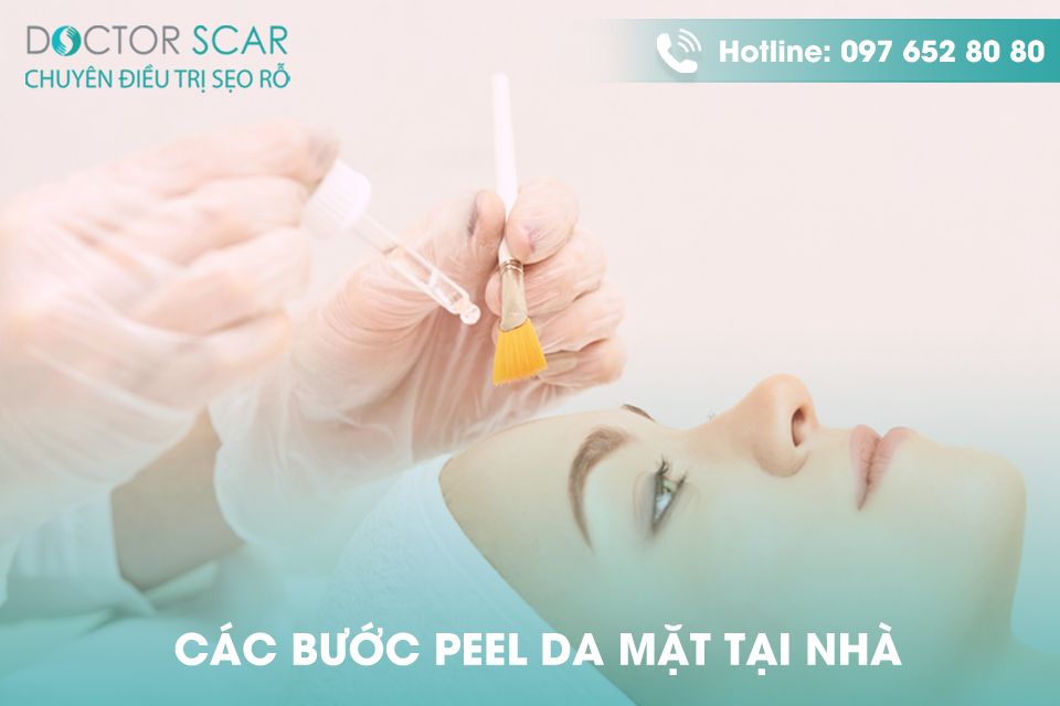 3 Bước peel da tại nhà chuẩn y khoa