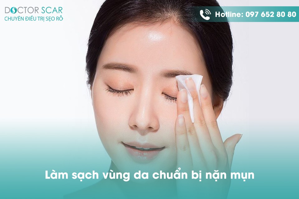 Làm sạch vùng da trước khi nặn mụn