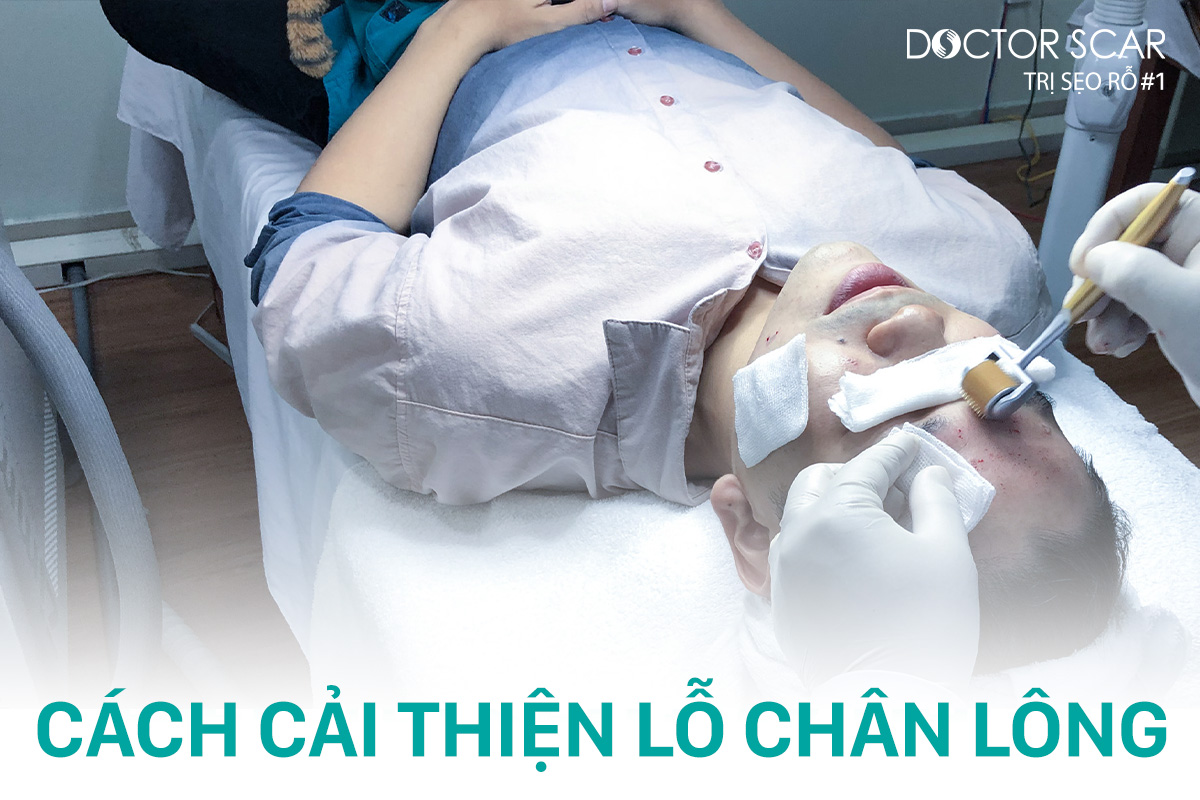 cách điều trị lỗ chân lông to