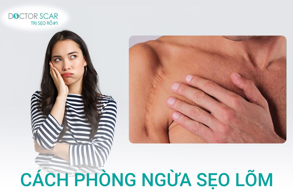 Cách phòng ngừa sẹo lõm