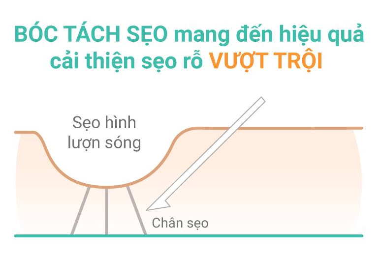 cach-tri-seo-lom-lau-nam-giup-hon-3500-nguoi-thoat-seo-3