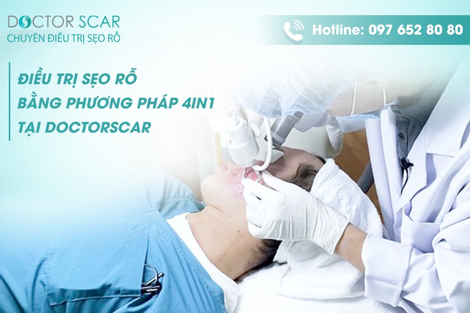 bị sẹo lõm sau khi tẩy nốt ruồi nên đến phòng khám doctorscar