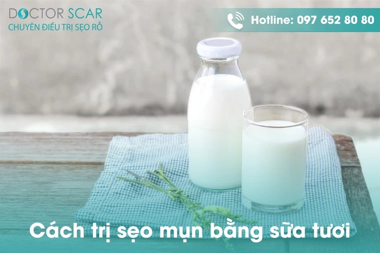 Cách trị sẹo mụn bằng sữa tươi