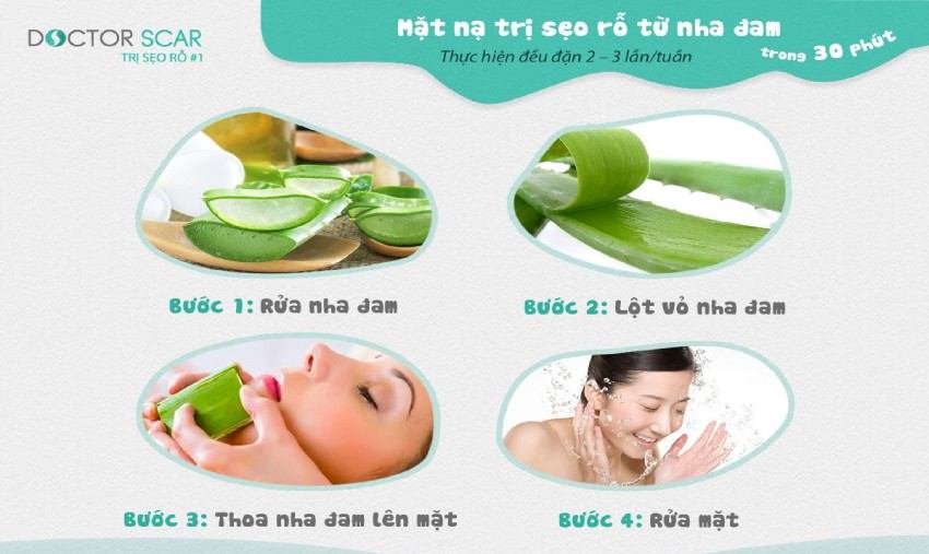 5 cách trị sẹo bằng nha đam tại nhà