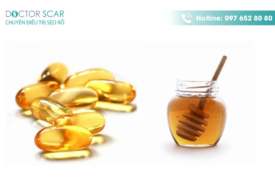 trị sẹo lõm bằng vitamin e và mật ong
