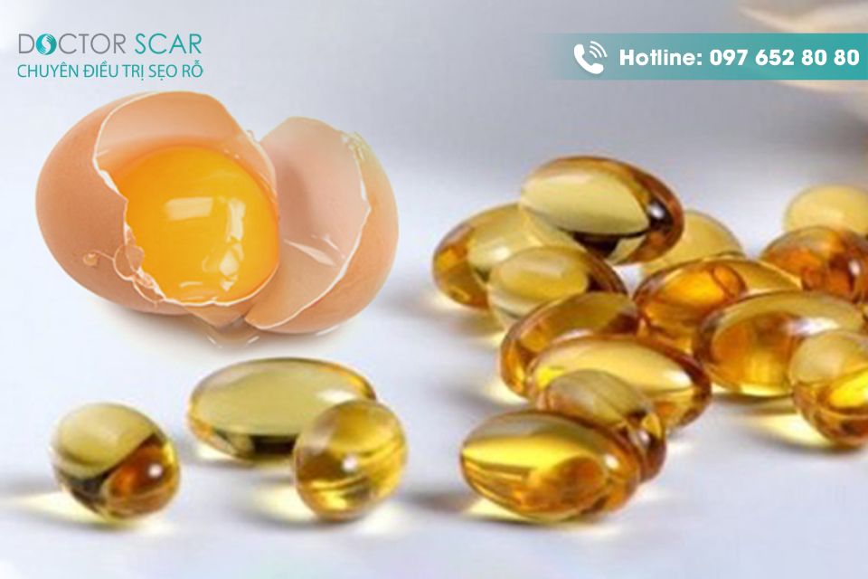 Điều trị sẹo lõm lâu năm bằng Vitamin E - trứng gà