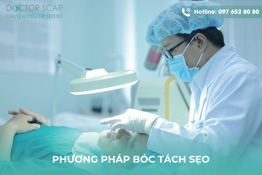 Trị sẹo thâm bằng phương pháp bóc tách sẹo