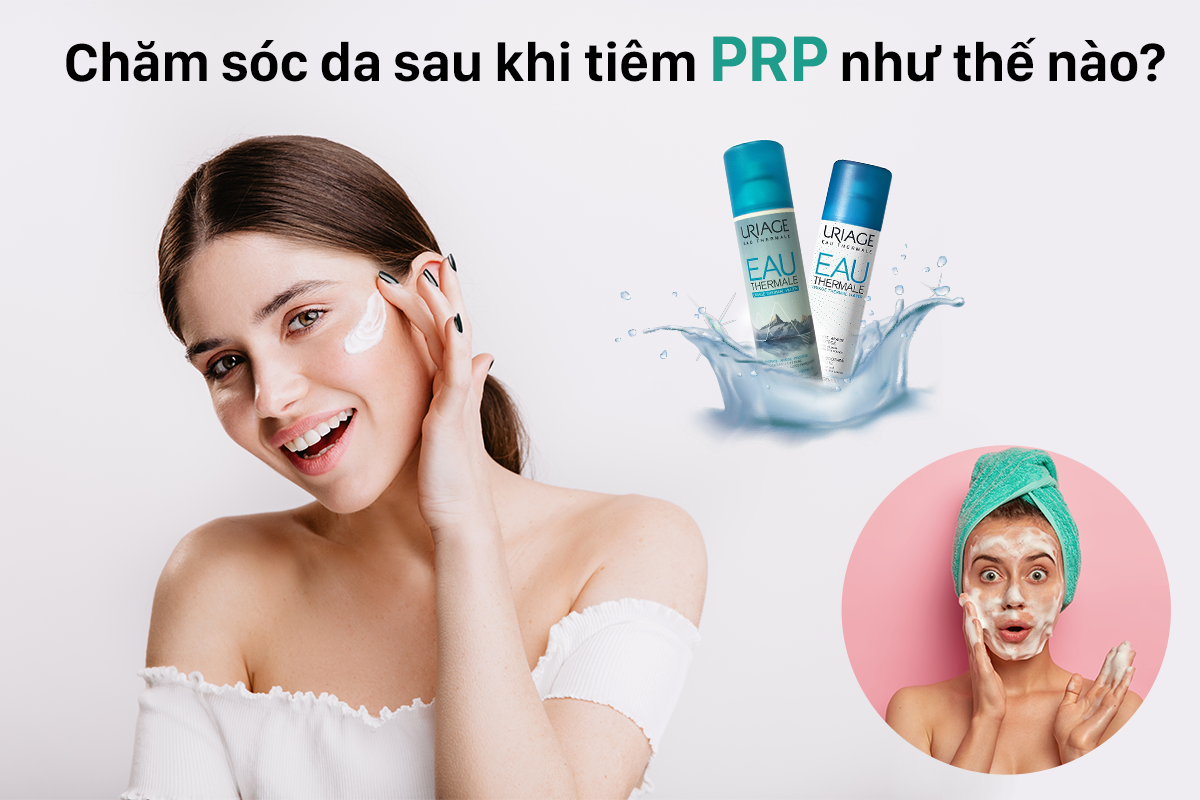 Hướng dẫn cách chăm sóc da sau khi tiêm prp