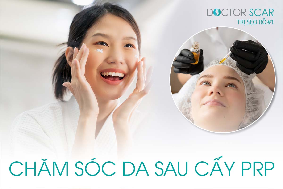 Hướng dẫn cách chăm sóc da sau cấy prp