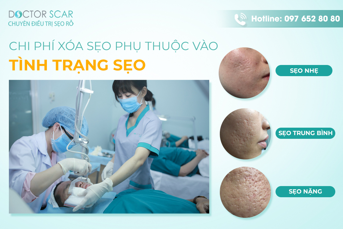 chi phí xóa sẹo giá bao nhiêu