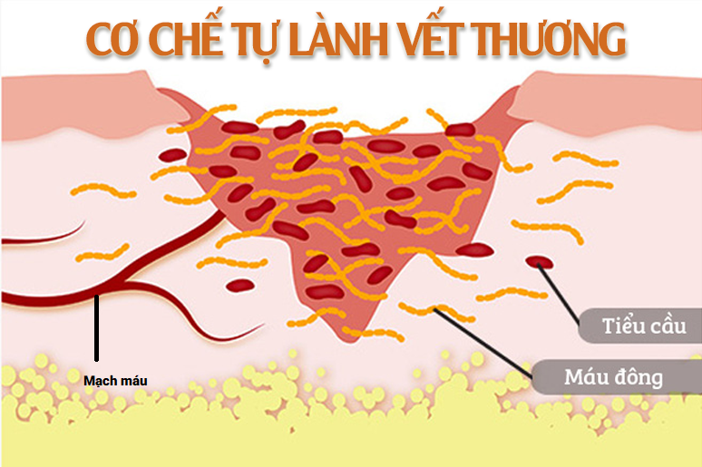 co-che-tu-lanh-thuong-cua-co-the-trong-dieu-tri-seo-ro