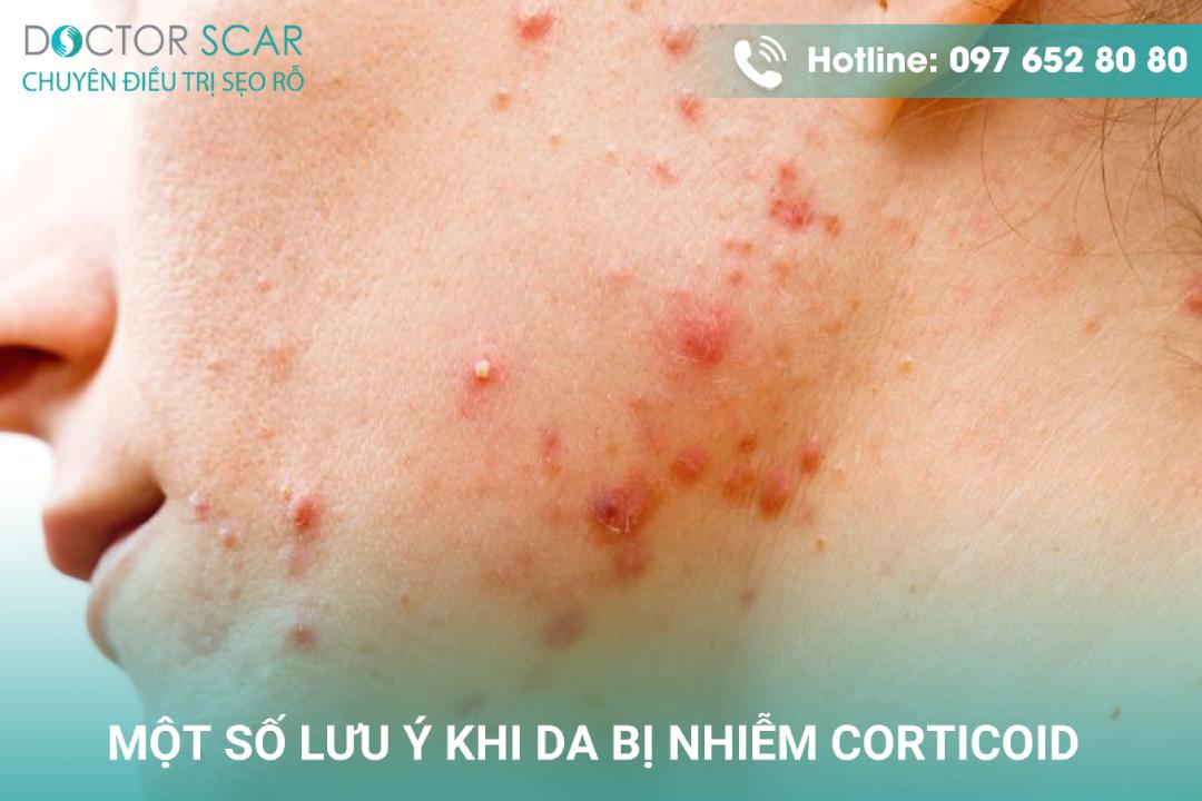 Da nhiễm corticoid có nên lăn kim không và những điều cần chú ý