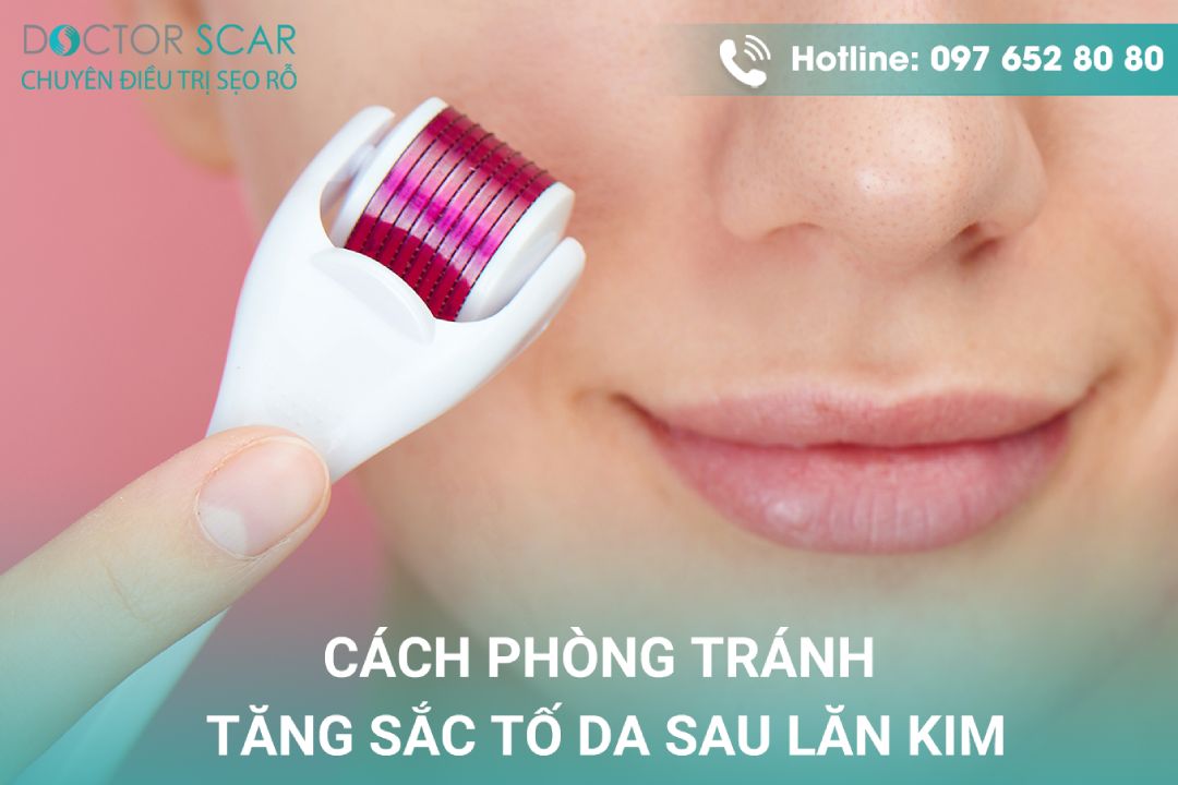 Cách phòng ngừa da bị tăng sắc tố sau lăn kim điều trị sẹo rỗ