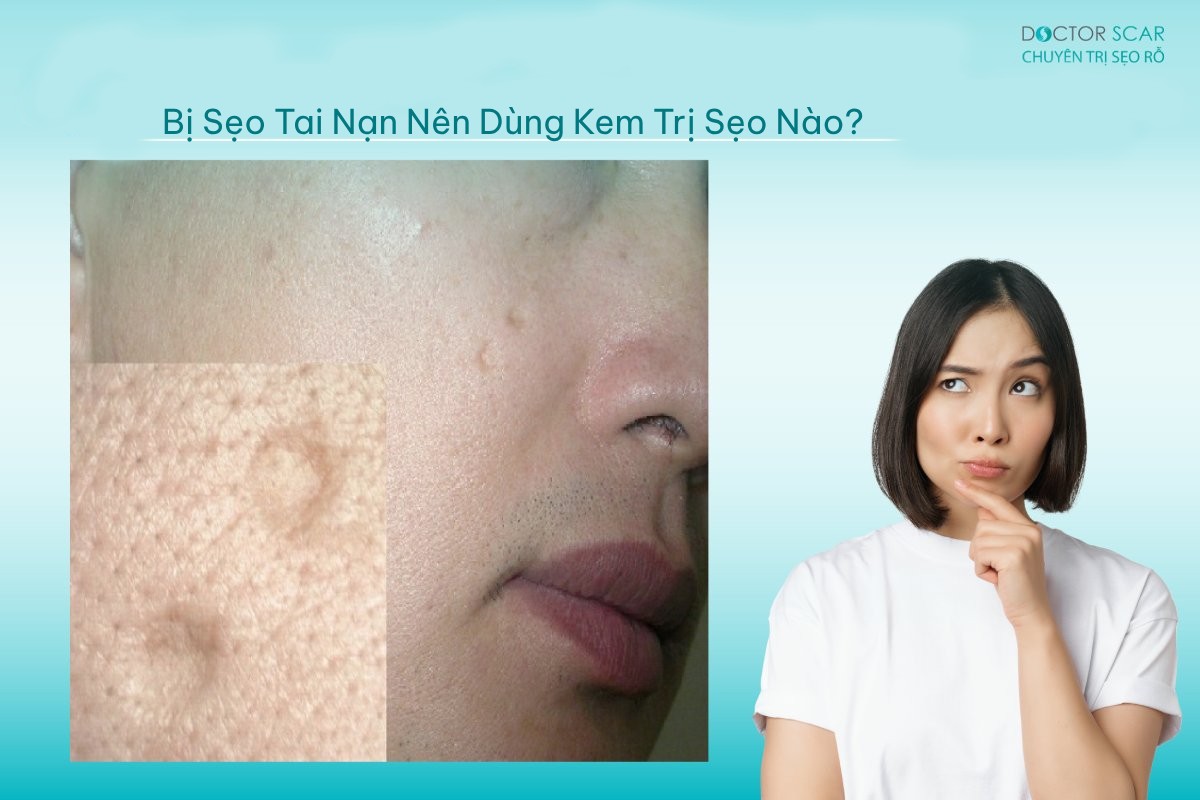 Đâu là kem trị sẹo tai nạn tốt hiện nay