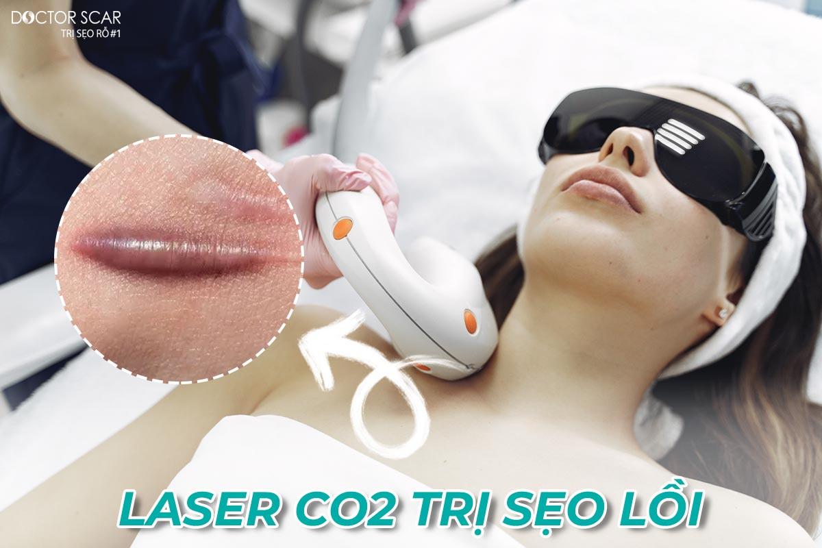 Công nghệ điều trị sẹo lồi bằng laser co2 fractional