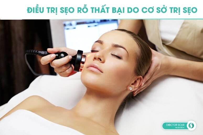 điều trị sẹo rỗ thất bại do chọn sai cơ sở điều trị