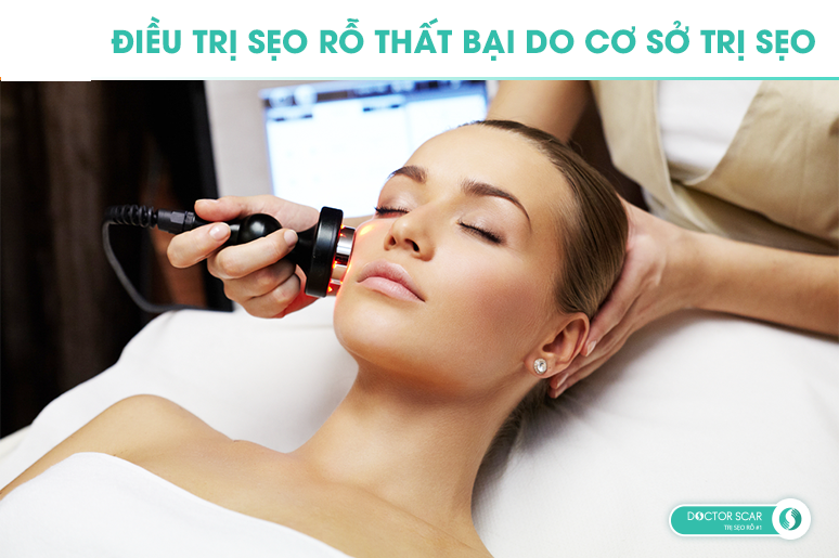 điều trị sẹo rỗ thất bại do chọn sai cơ sở điều trị