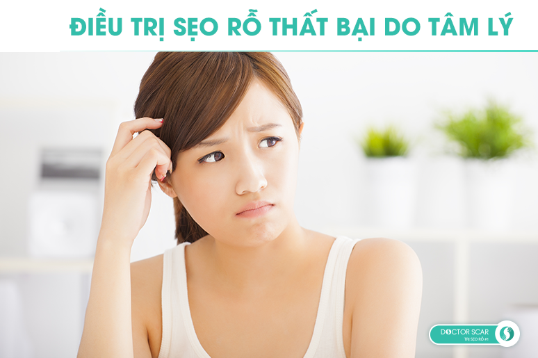 điều trị sẹo rỗ thất bại do tâm lý