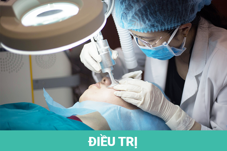 dieu-tri-seo-ro