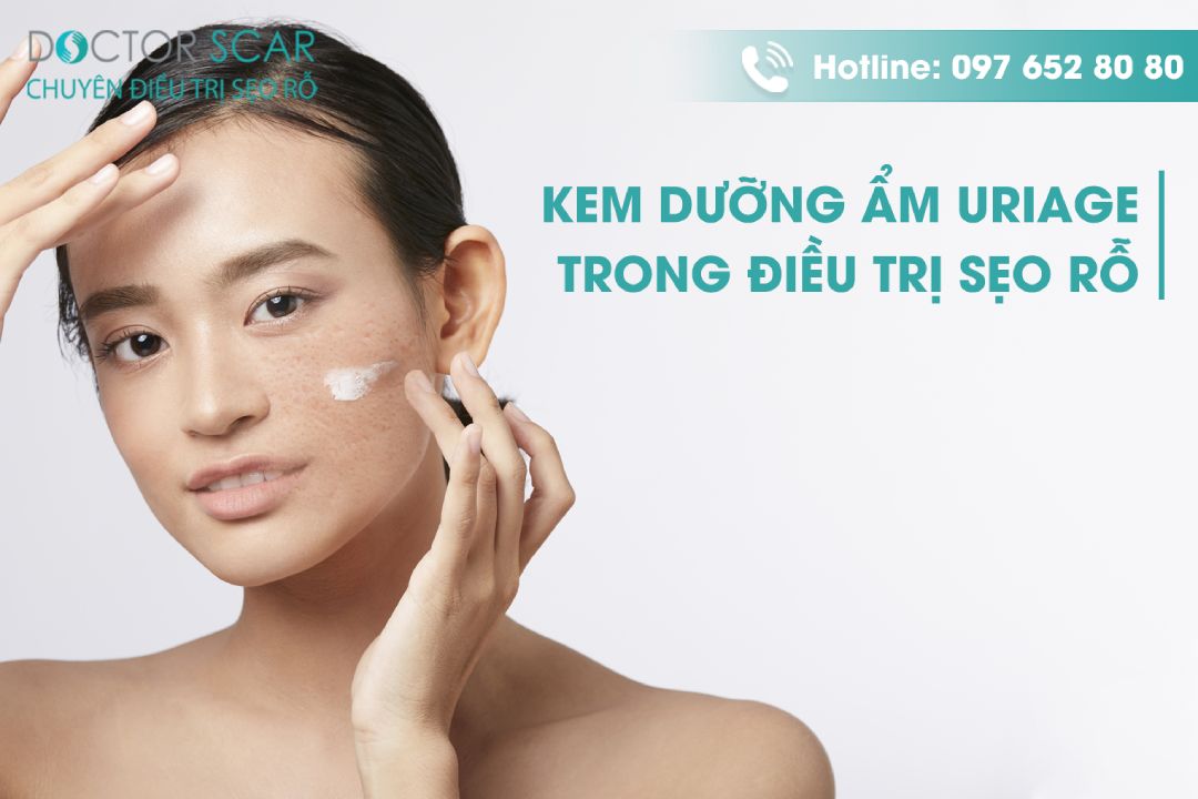 tác dụng của kem dưỡng ẩm uriage trong trị sẹo rỗ