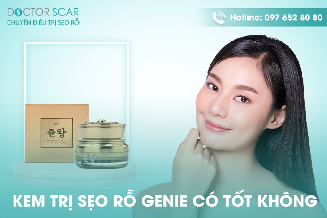 Kem trị sẹo genie có tốt không