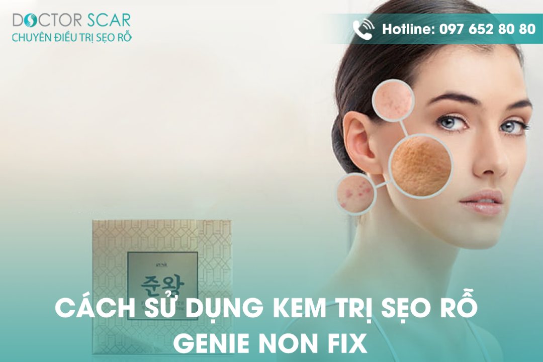 Cách dùng kem trị sẹo rỗ genie non fix