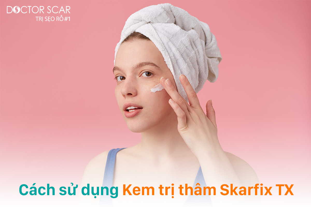 Cách sử dụng kem trị sẹo thâm skarfix tx