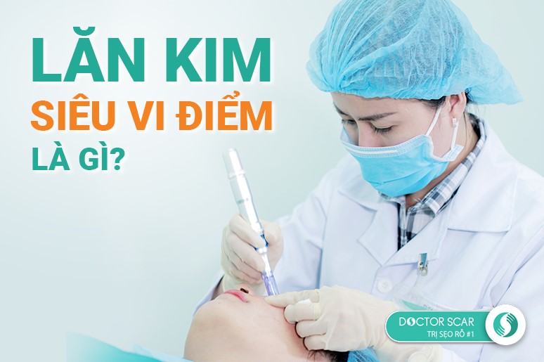 lăn kim siêu vi điểm là gì