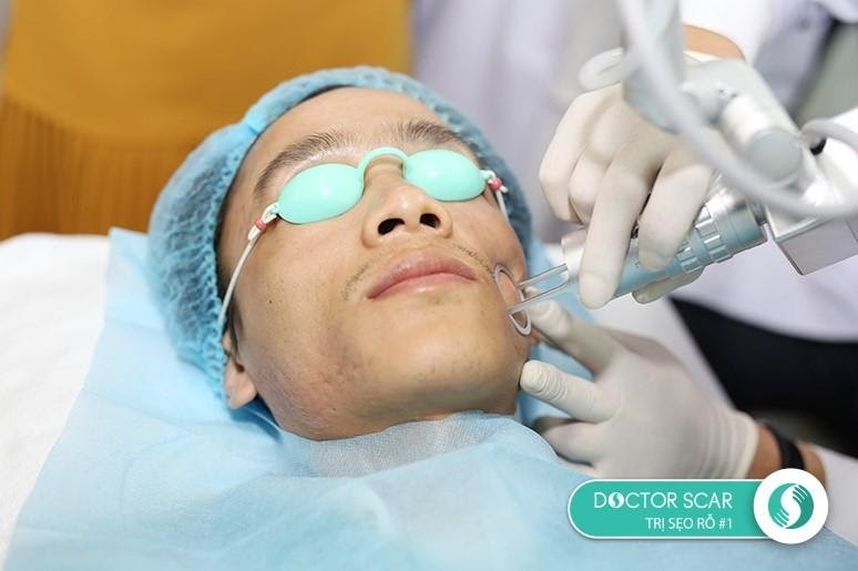 phương pháp laser fractional co2
