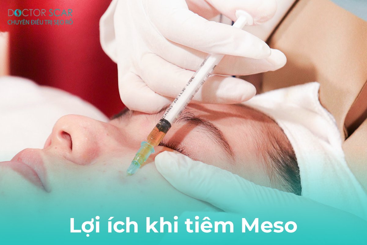 Lợi ích của việc tiêm mesotherapy