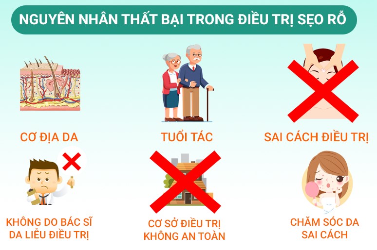 nguyên nhân thất bại trong việc điều trị sẹo rỗ