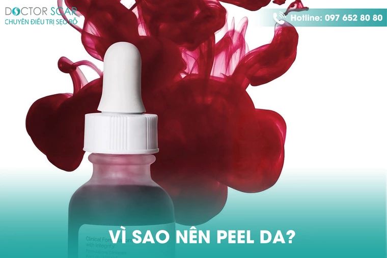 Vì sao nên peel da