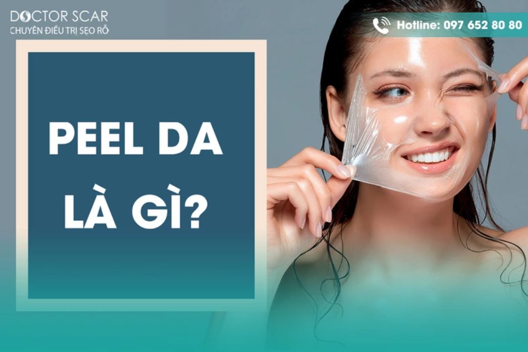 Peel da trị sẹo rỗ là gì