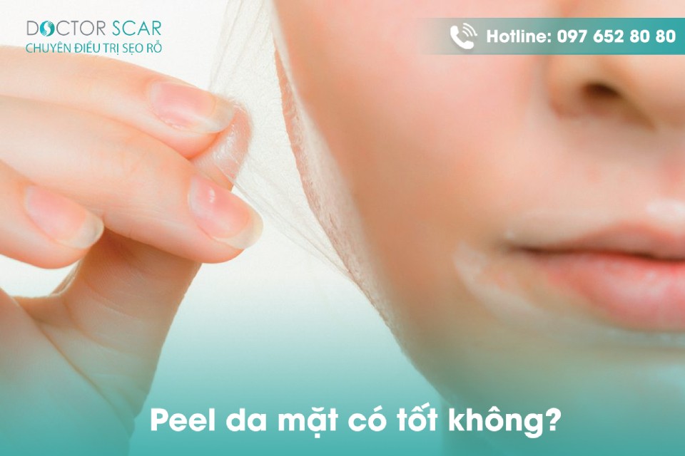 peel da mặt có tốt không?