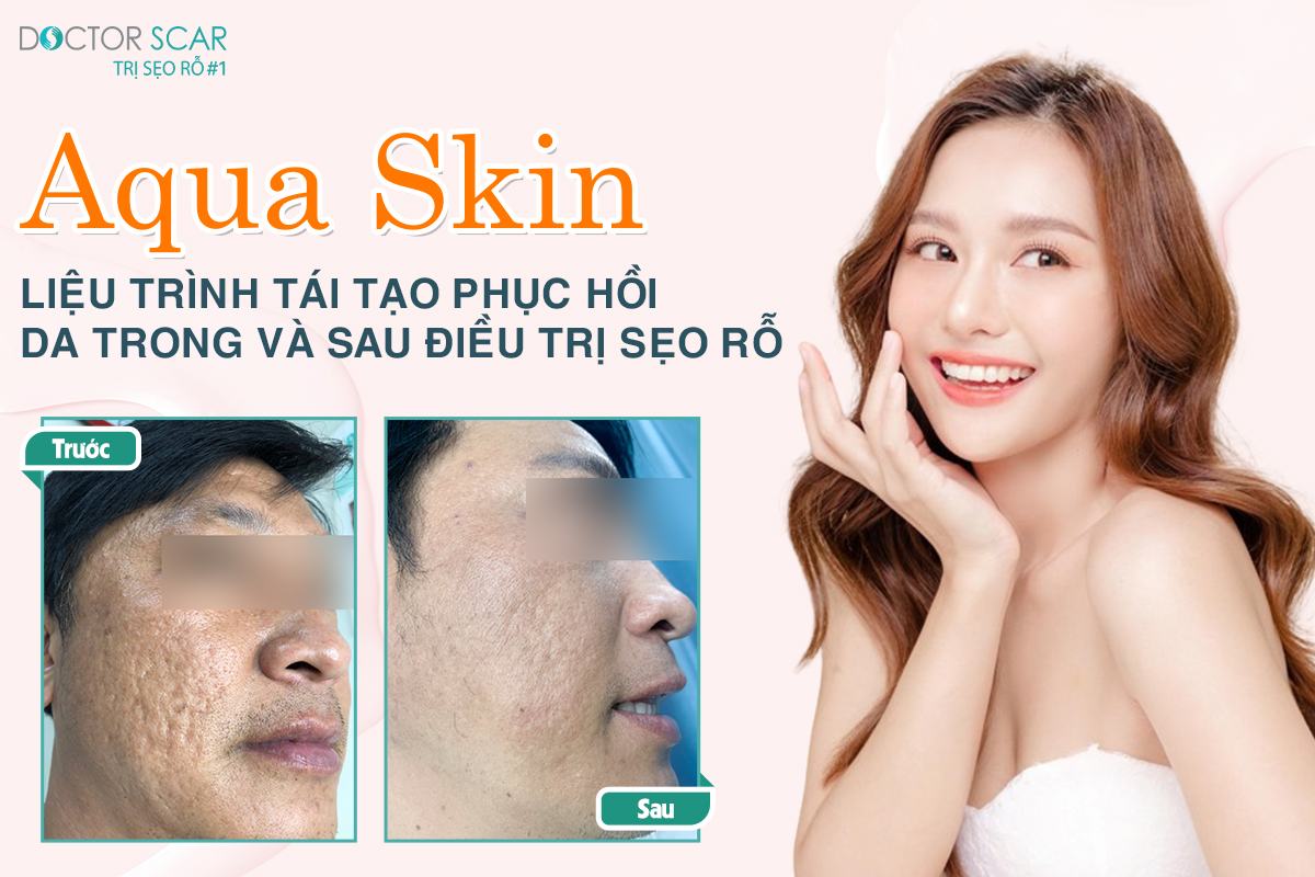 aqua skin trong điều trị sẹo rỗ