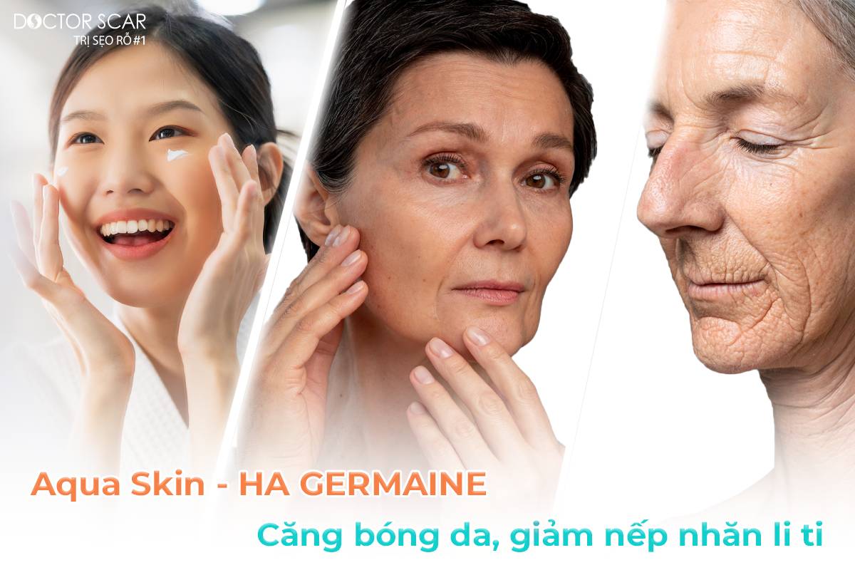 aqua skin cấp ẩm và phục hồi da sau laser