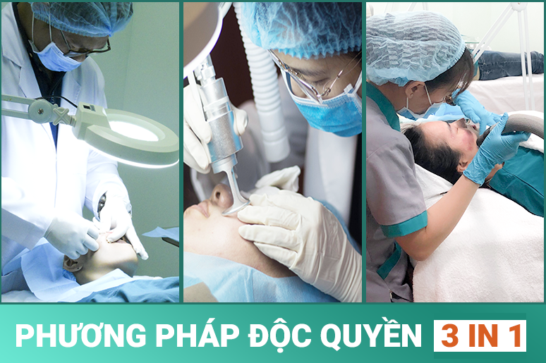 phương pháp điều trị sẹo rỗ độc quyền 3IN1 tại Doctor Scar