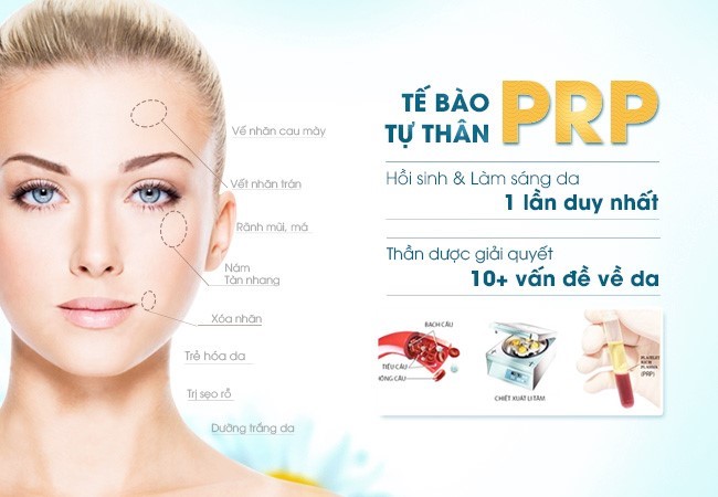 Thẫm mỹ bằng công nghệ PRP có gây hại cho sức khỏe Phuong-phap-lan-kim-prp-la-gi