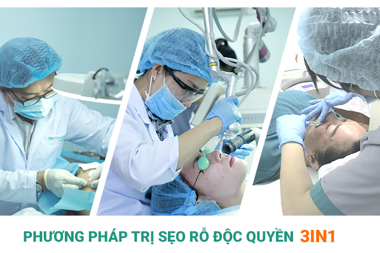 phương pháp trị sẹo rỗ 3in Doctor Scar
