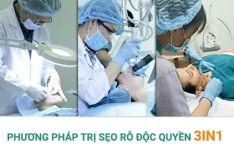 phương pháp trị sẹo rỗ độc quyền 3in1 Doctor Scar