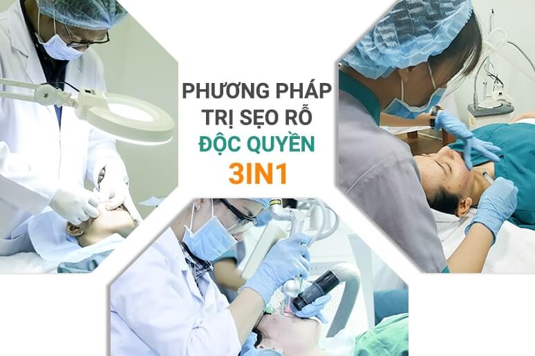 phương pháp trị sẹo rỗ độc quyền 3in1 Doctor Scar